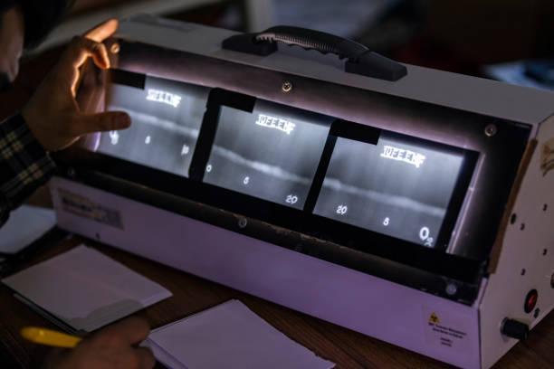 AI in Digital Radiographic Image Interpretation